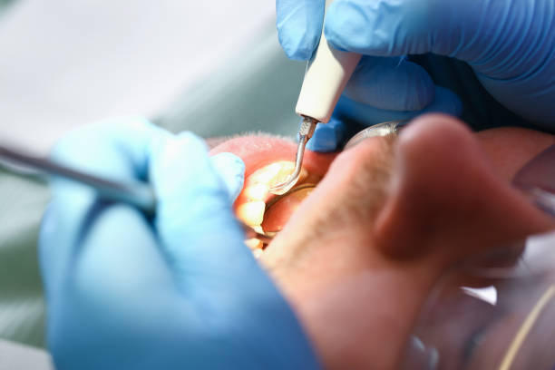 Best Emergency Denture Repair in Silver Springs Shores, FL