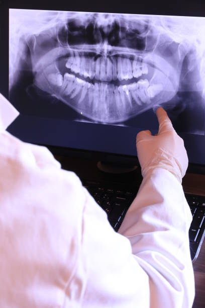Best Broken or Chipped Tooth Repair in Silver Springs Shores, FL